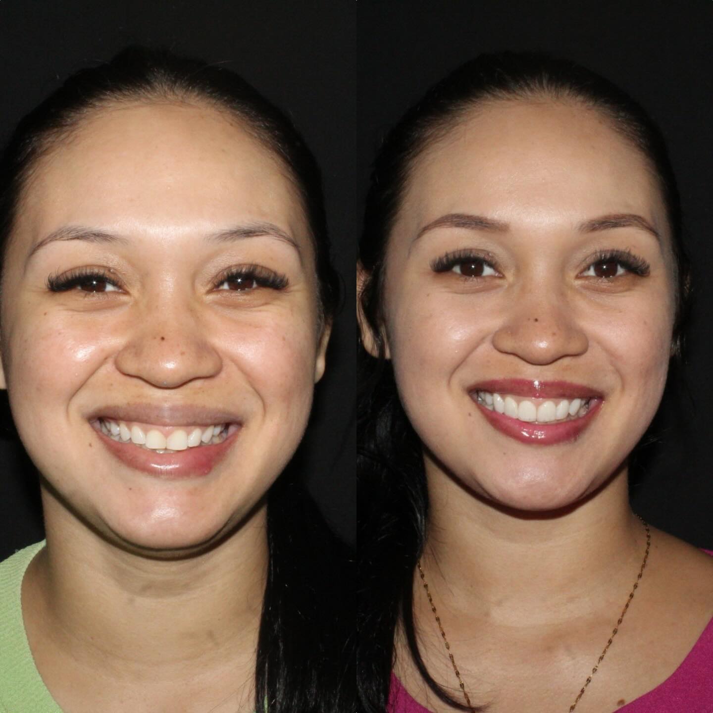 Facetas — registro original 1 de 4