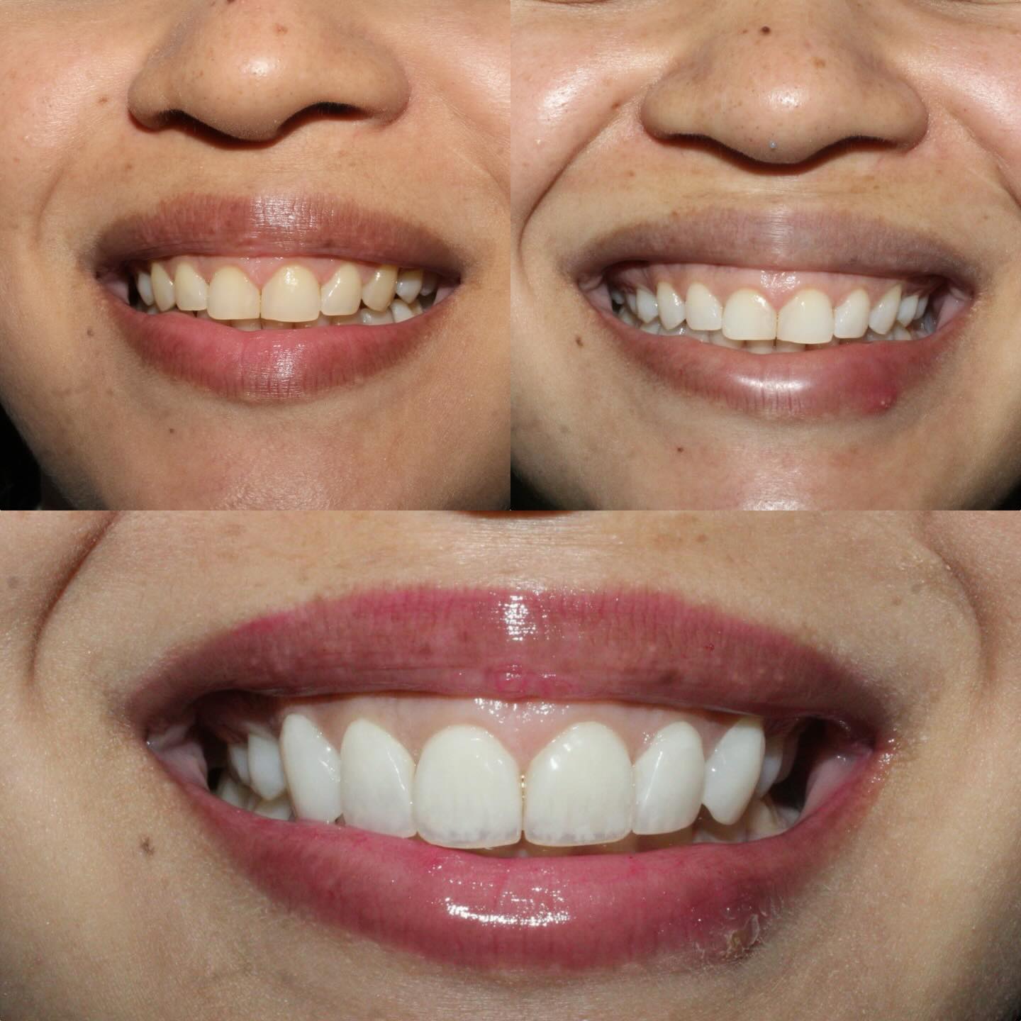 Facetas — registro original 2 de 4