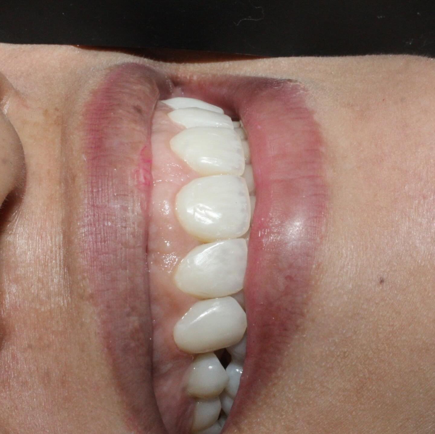 Facetas — registro original 3 de 4